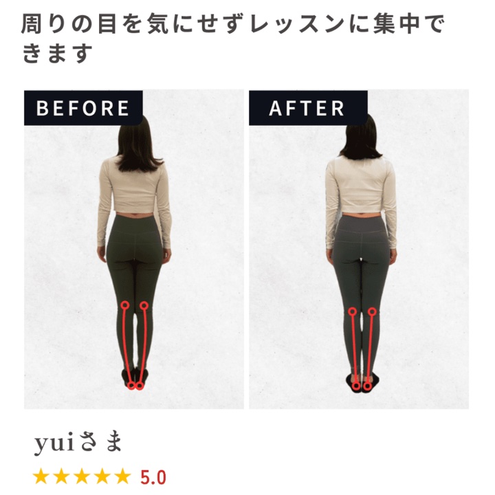 お客様（yuiさま）のビフォーアフター写真。後ろから見て、ひざから足首にかけての脚のラインがまっすぐに近づいた様子。お客様の声「周りの目を気にせずレッスンに集中できます」